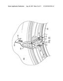 Lock Ring Spreader diagram and image