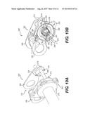 LIMITER STRAP ADJUSTMENT SYSTEM FOR A SNOWMOBILE SUSPENSION diagram and image