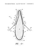 METHODS AND SYSTEMS FOR REMOVING AND/OR INSTALLING WIND TURBINE ROTOR     BLADES diagram and image