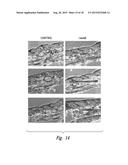 CBP/CATENIN ANTAGONISTS FOR ENHANCING ASYMMETRIC DIVISION OF SOMATIC STEM     CELLS diagram and image