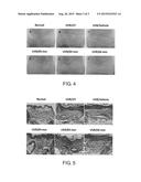 USE OF PEDF-DERIVED POLYPEPTIDES FOR PREVENTING AND/OR AMELIORATING SKIN     AGING diagram and image