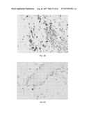 RECOMBINANT SEROTYPE 5 (Ad5) ADENOVIRAL VECTORS diagram and image