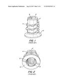 Plastic Product with Insert diagram and image