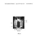 RAPID MEASUREMENT OF FORMED BLOOD COMPONENT SEDIMENTATION RATE FROM SMALL     SAMPLE VOLUMES diagram and image