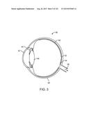 DETERMINING USER ACCOMMODATION TO PROJECT IMAGE DATA AT A DESIRED FOCAL     DISTANCE diagram and image