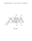 DETERMINING USER ACCOMMODATION TO PROJECT IMAGE DATA AT A DESIRED FOCAL     DISTANCE diagram and image