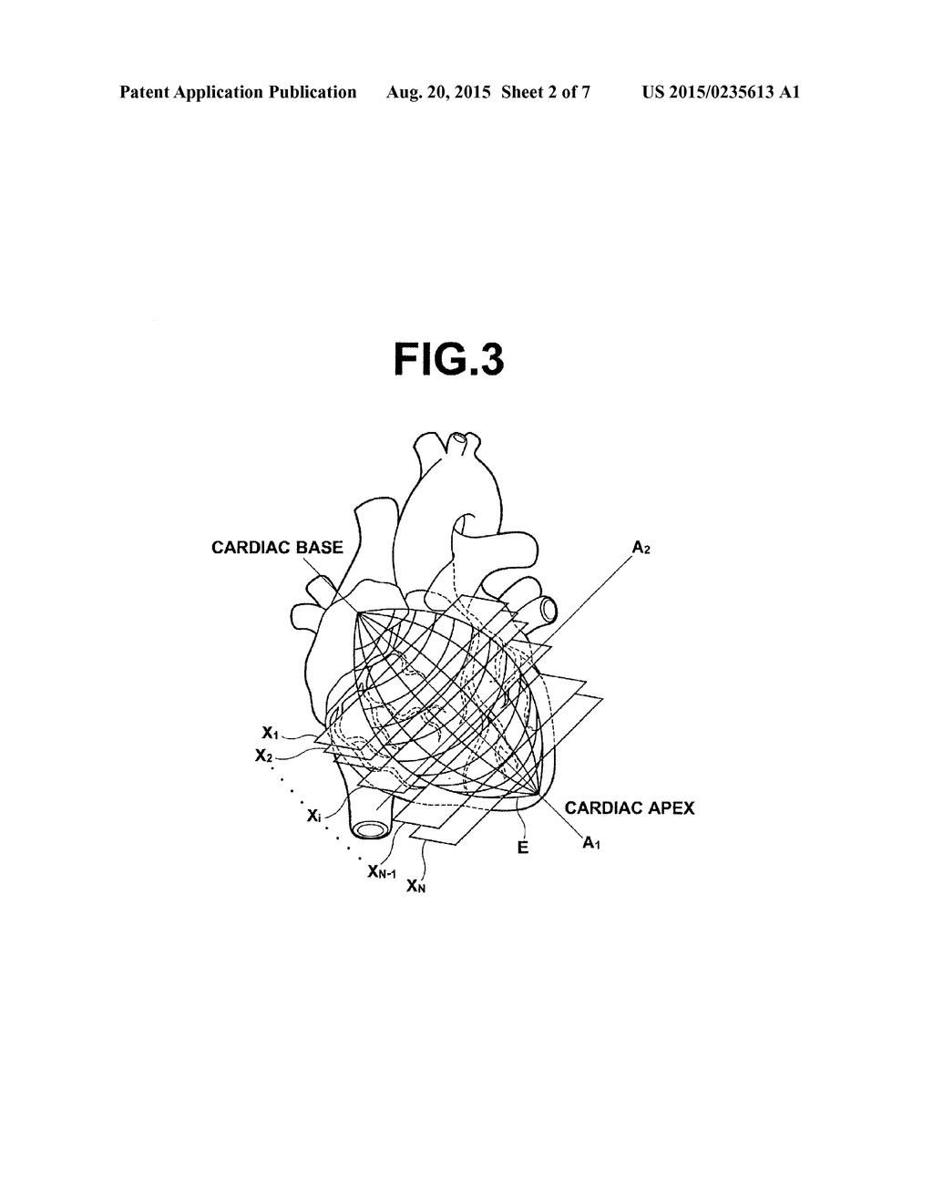 MEDICAL IMAGE DISPLAY CONTROL APPARATUS AND OPERATION METHOD OF THE SAME,     AND MEDIUM - diagram, schematic, and image 03