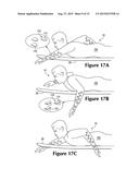 WETSUITS WITH HYDRODYNAMIC INTERLOCKING AND KINESIOLOGIC FEATURES diagram and image