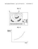 ENDOSCOPE SYSTEM, ENDOSCOPE SYSTEM PROCESSOR DEVICE, OPERATION METHOD FOR     ENDOSCOPE SYSTEM, AND OPERATION METHOD FOR ENDOSCOPE SYSTEM PROCESSOR     DEVICE diagram and image