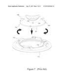 DISPOSABLE EYEPIECE SYSTEM FOR AN ULTRASONIC EYE SCANNING diagram and image