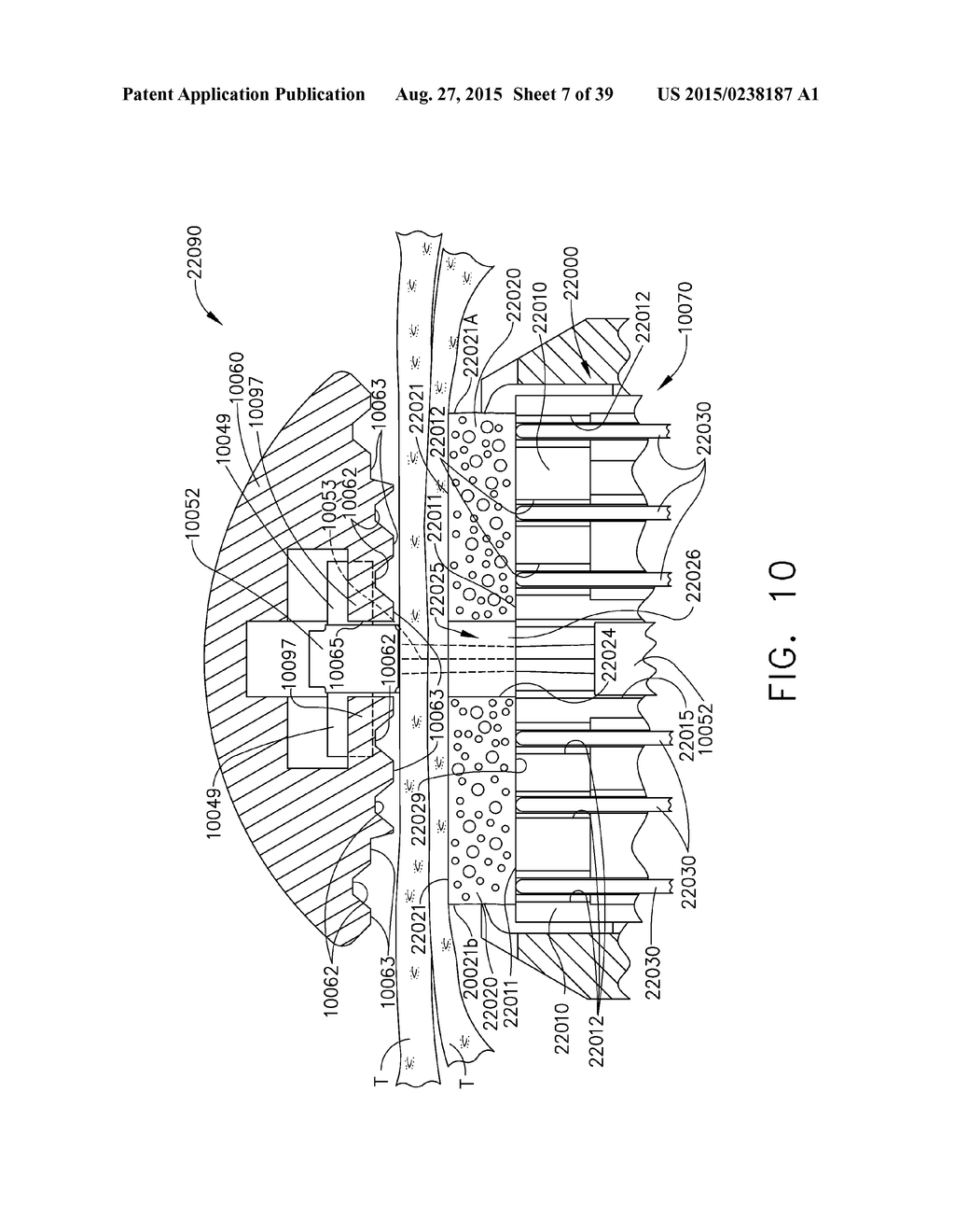 IMPLANTABLE LAYER ASSEMBLIES - diagram, schematic, and image 08