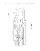 IMPLANTABLE LAYER ASSEMBLIES diagram and image