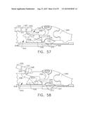 IMPLANTABLE LAYER ASSEMBLIES diagram and image