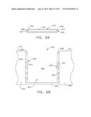 IMPLANTABLE LAYER ASSEMBLIES diagram and image