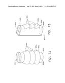 IMPLANTABLE LAYER ASSEMBLIES diagram and image