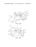 IMPLANTABLE LAYERS COMPRISING A PRESSED REGION diagram and image