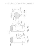 IMPLANTABLE LAYERS COMPRISING A PRESSED REGION diagram and image