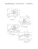 HEMOSTASIS DEVICES AND METHODS UTILIZING MECHANICAL METHODS diagram and image