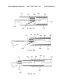 HEMOSTASIS DEVICES AND METHODS UTILIZING MECHANICAL METHODS diagram and image