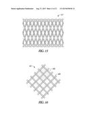 ELONGATE EXPANDABLE MEMBER FOR OCCLUDING VASCULAR VESSEL diagram and image