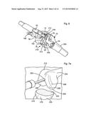 LEG ALIGNMENT APPARATUS AND METHOD diagram and image