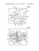 LEG ALIGNMENT APPARATUS AND METHOD diagram and image