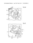 LEG ALIGNMENT APPARATUS AND METHOD diagram and image