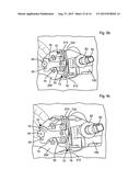 LEG ALIGNMENT APPARATUS AND METHOD diagram and image