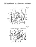 LEG ALIGNMENT APPARATUS AND METHOD diagram and image