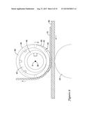 SKIN GRAFT PREPARATION DEVICE diagram and image