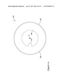 SKIN GRAFT PREPARATION DEVICE diagram and image