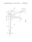 SURGICAL INSTRUMENT AND METHOD diagram and image