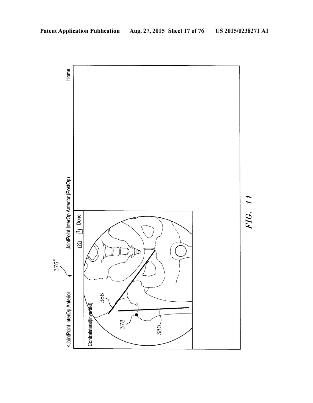 Systems and Methods for Intra-Operative Image Analysis - diagram, schematic, and image 18