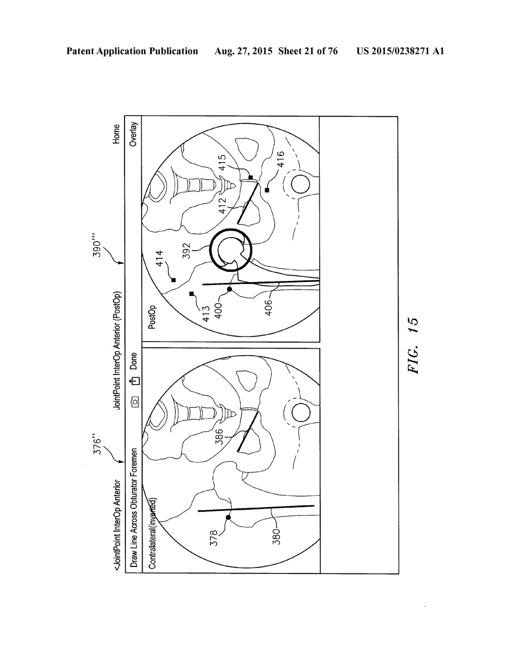 Systems and Methods for Intra-Operative Image Analysis - diagram, schematic, and image 22