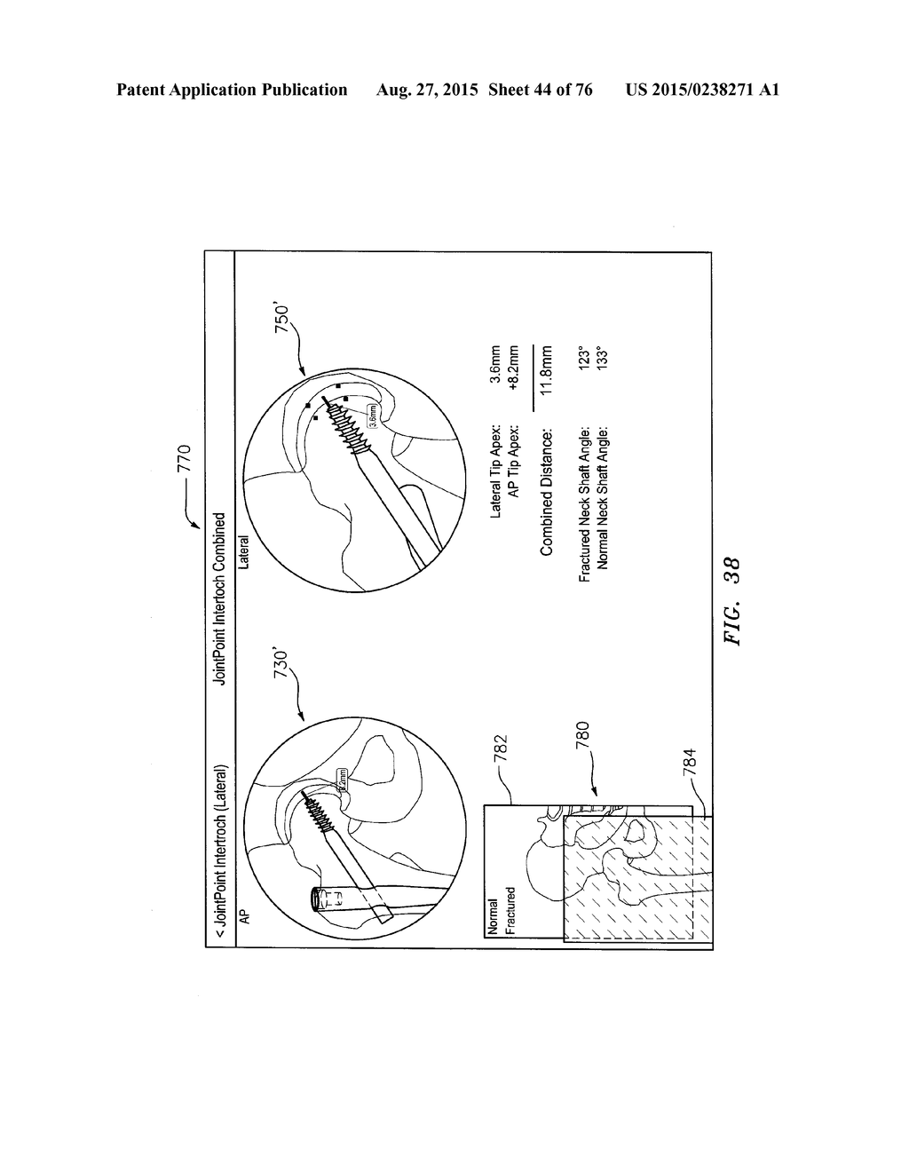 Systems and Methods for Intra-Operative Image Analysis - diagram, schematic, and image 45