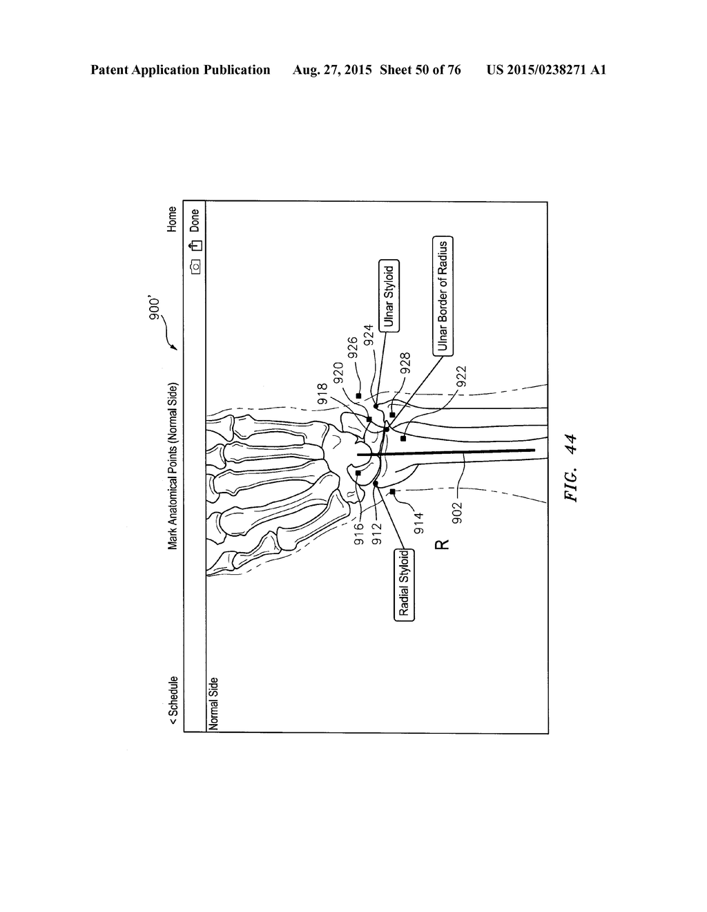 Systems and Methods for Intra-Operative Image Analysis - diagram, schematic, and image 51