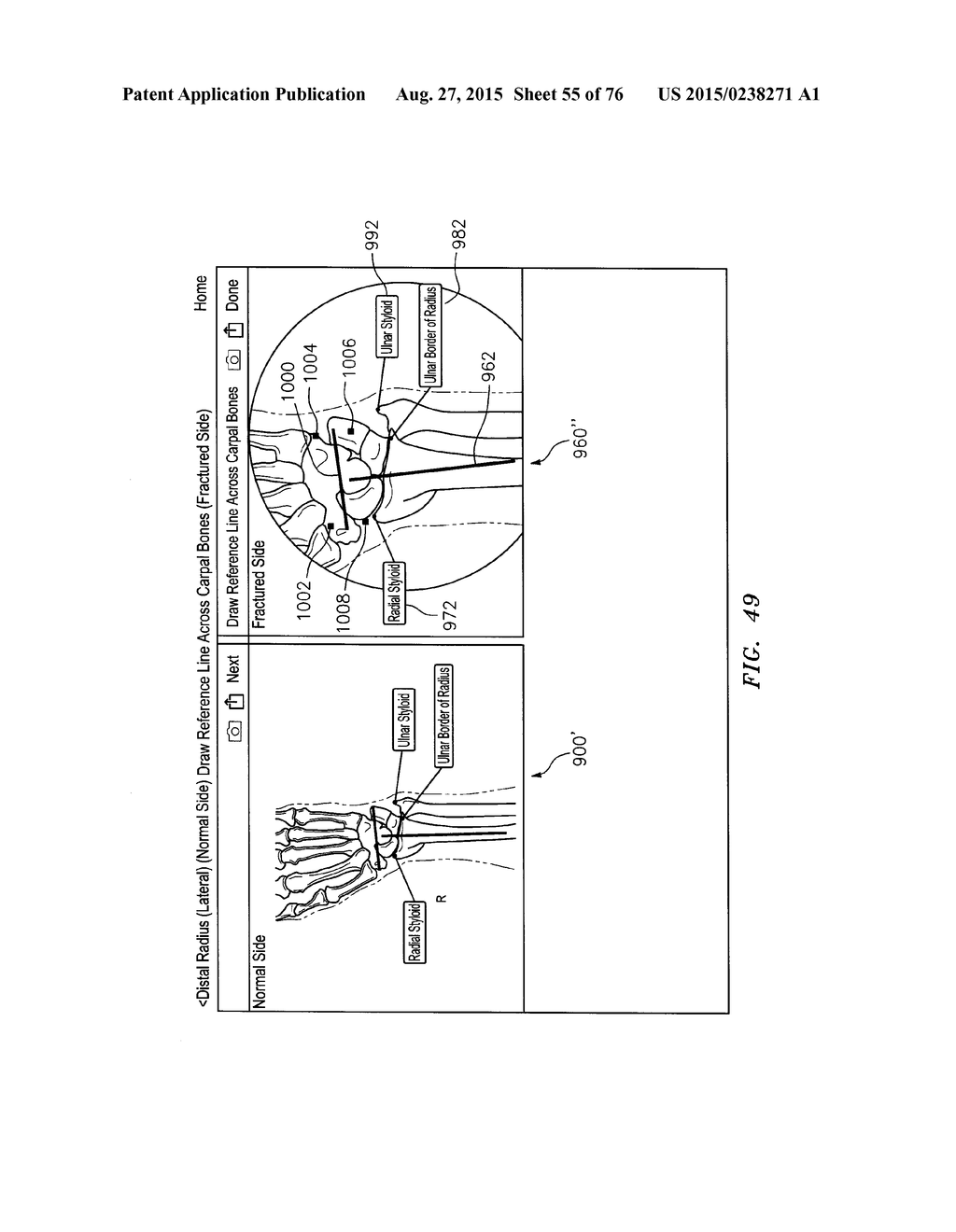 Systems and Methods for Intra-Operative Image Analysis - diagram, schematic, and image 56