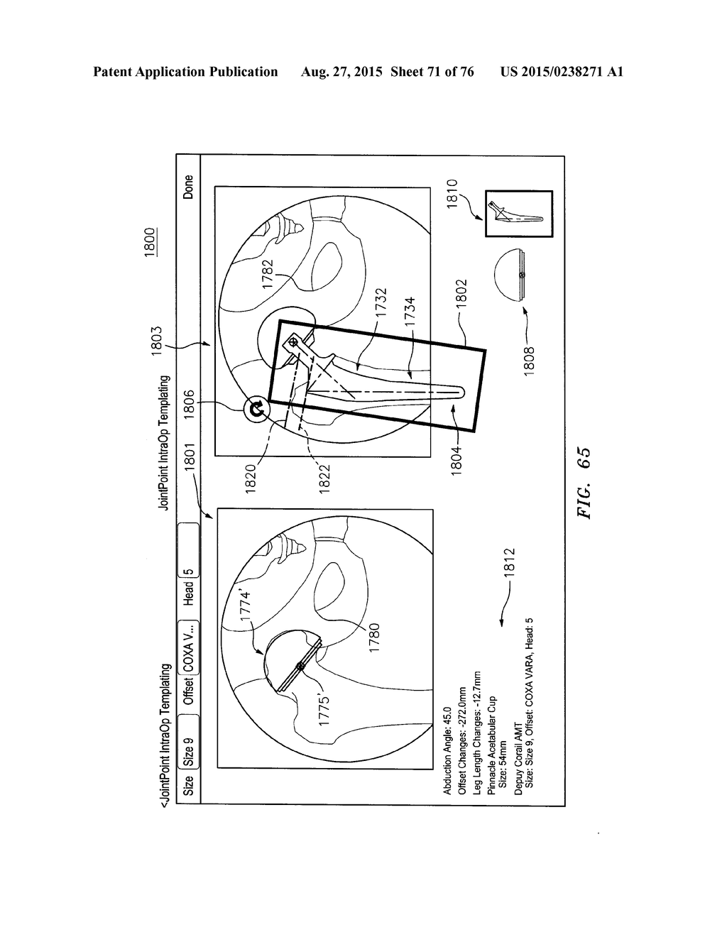 Systems and Methods for Intra-Operative Image Analysis - diagram, schematic, and image 72