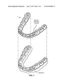 ORTHODONTIC APPLIANCES THAT ACCOMMODATE INCREMENTAL AND CONTINUOUS TOOTH     MOVEMENT, SYSTEMS AND METHODS diagram and image