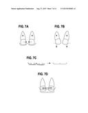 ORTHODONTIC APPLIANCES THAT ACCOMMODATE INCREMENTAL AND CONTINUOUS TOOTH     MOVEMENT, SYSTEMS AND METHODS diagram and image