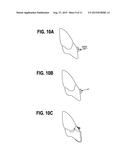 ORTHODONTIC APPLIANCES THAT ACCOMMODATE INCREMENTAL AND CONTINUOUS TOOTH     MOVEMENT, SYSTEMS AND METHODS diagram and image