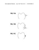 ORTHODONTIC APPLIANCES THAT ACCOMMODATE INCREMENTAL AND CONTINUOUS TOOTH     MOVEMENT, SYSTEMS AND METHODS diagram and image