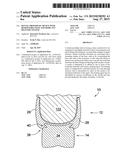 DENTAL PROSTHETIC DEVICE WITH REMOLDABLE BASE AND MEDICANT DELIVERY SYSTEM diagram and image