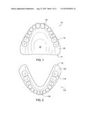 DENTAL PROSTHETIC DEVICE WITH REMOLDABLE BASE AND MEDICANT DELIVERY SYSTEM diagram and image