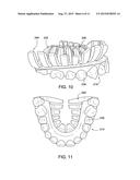 DENTAL PROSTHETIC DEVICE WITH REMOLDABLE BASE AND MEDICANT DELIVERY SYSTEM diagram and image