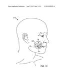 DENTAL PROSTHETIC DEVICE WITH REMOLDABLE BASE AND MEDICANT DELIVERY SYSTEM diagram and image