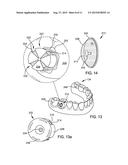 DENTAL PROSTHETIC DEVICE WITH REMOLDABLE BASE AND MEDICANT DELIVERY SYSTEM diagram and image