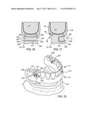 DENTAL PROSTHETIC DEVICE WITH REMOLDABLE BASE AND MEDICANT DELIVERY SYSTEM diagram and image