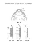 DENTAL PROSTHETIC DEVICE WITH REMOLDABLE BASE AND MEDICANT DELIVERY SYSTEM diagram and image