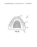 DENTAL PROSTHETIC DEVICE WITH REMOLDABLE BASE AND MEDICANT DELIVERY SYSTEM diagram and image